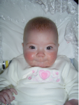 hypoplastic left heart syndrome, congenital heart disease