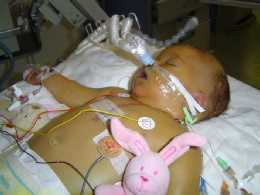 hypoplastic left heart syndrome, congenital heart disease