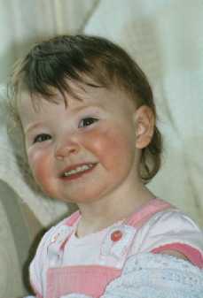 hypoplastic left heart syndrome, congenital heart disease