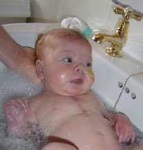 hypoplastic left heart syndrome, congenital heart disease
